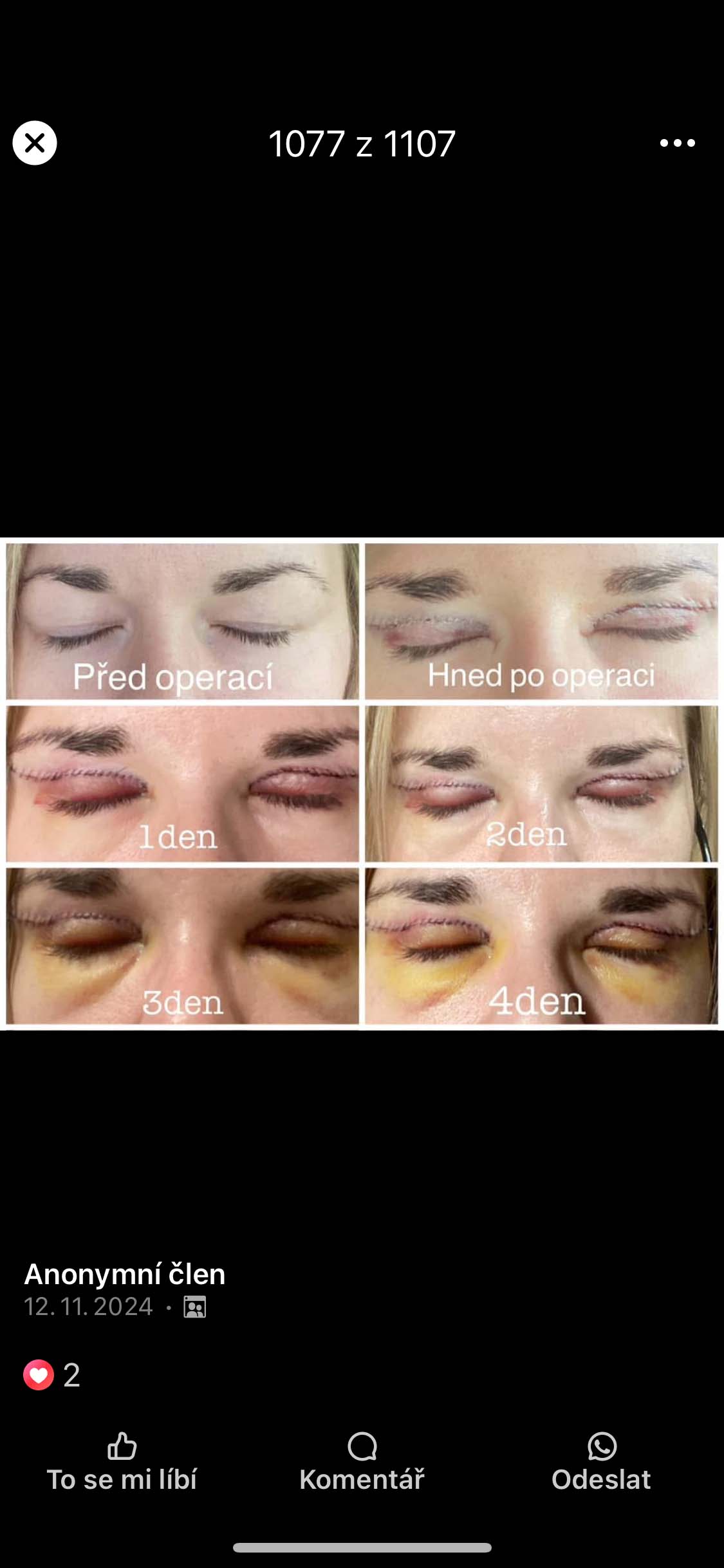 Víčka - 12. 11. 2024