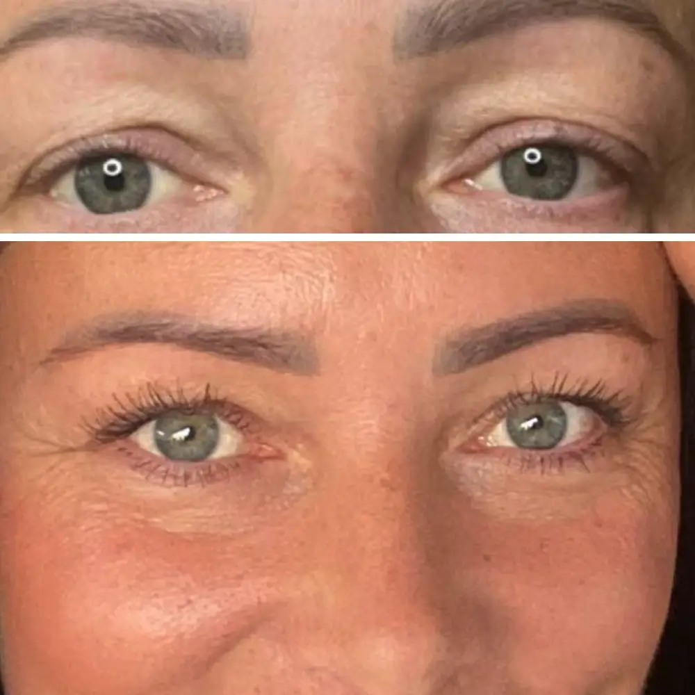 Markéta Hlaváčková - víčka