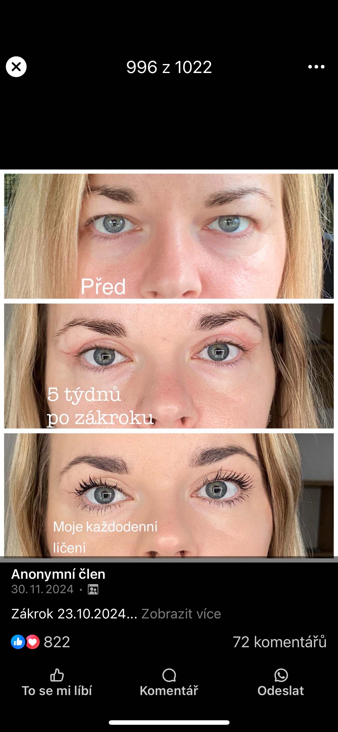 Víčka - 23. 10. 2024