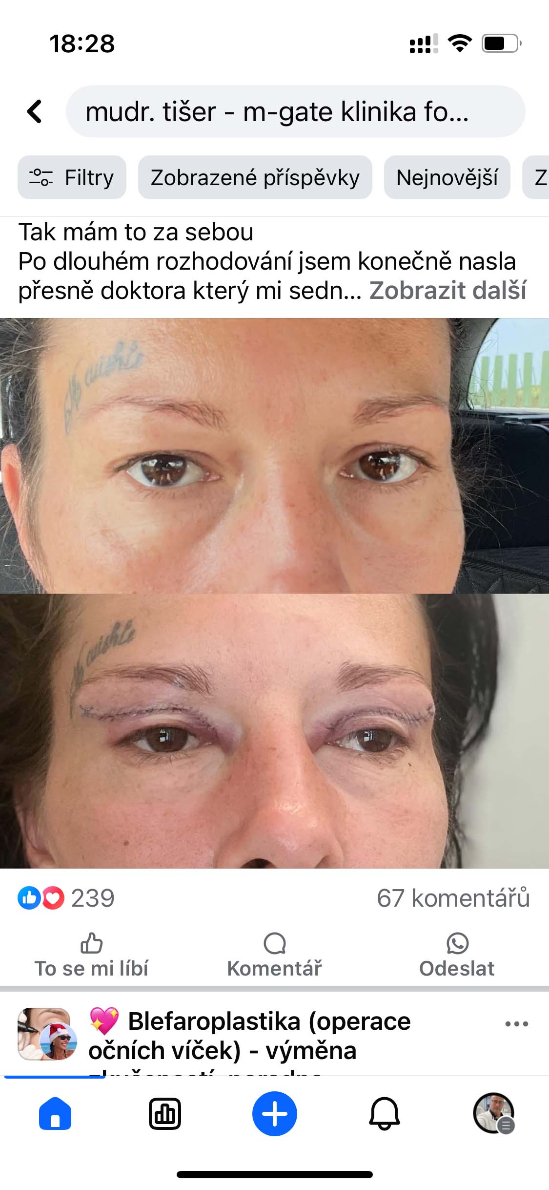 Víčka - 4. 5. 2025