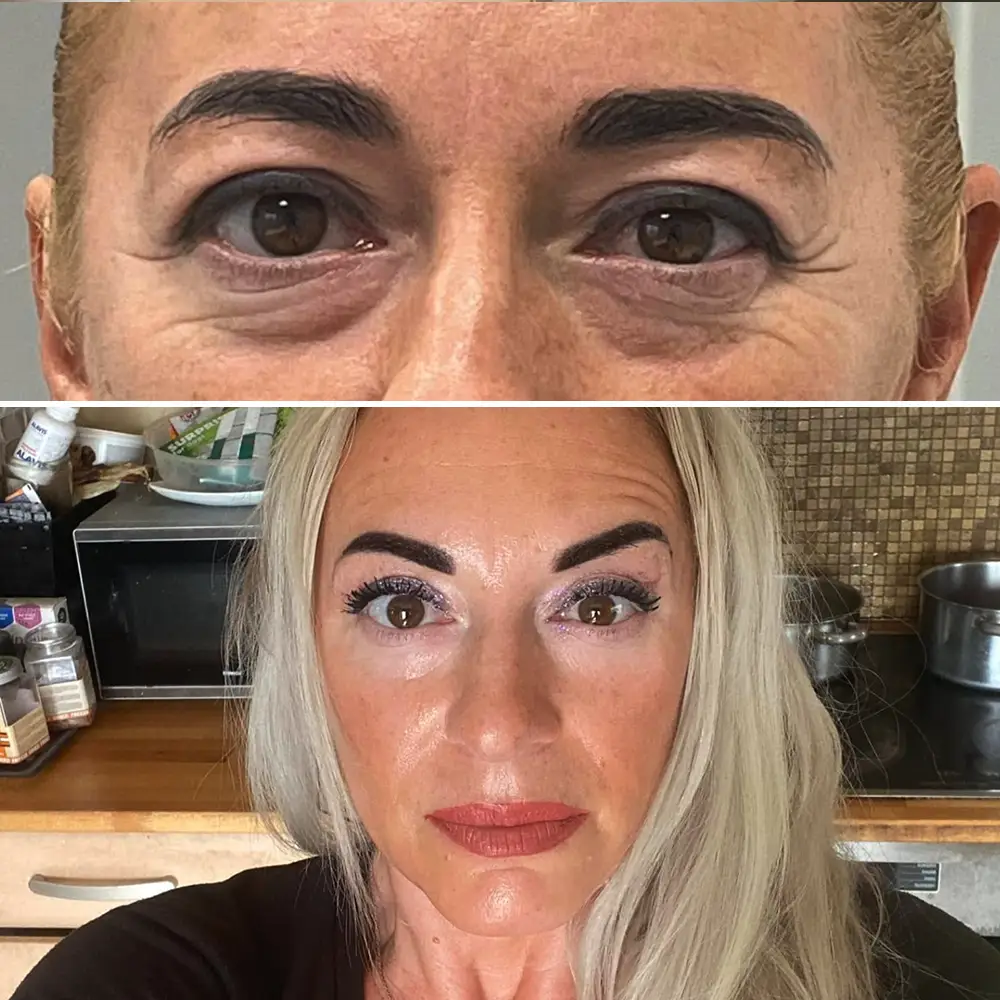 Denisa Háková - víčka