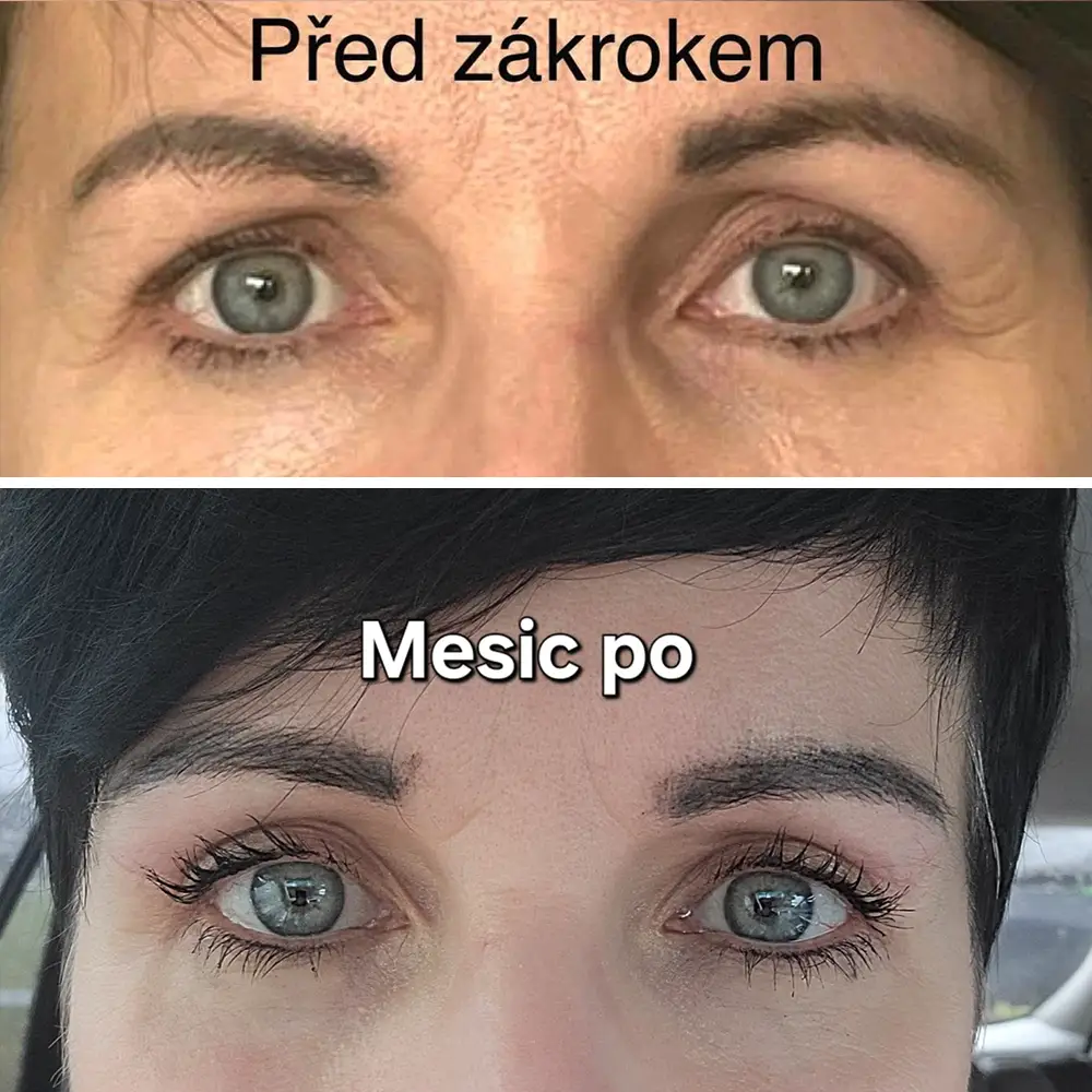 Marcela Faltynek - víčka