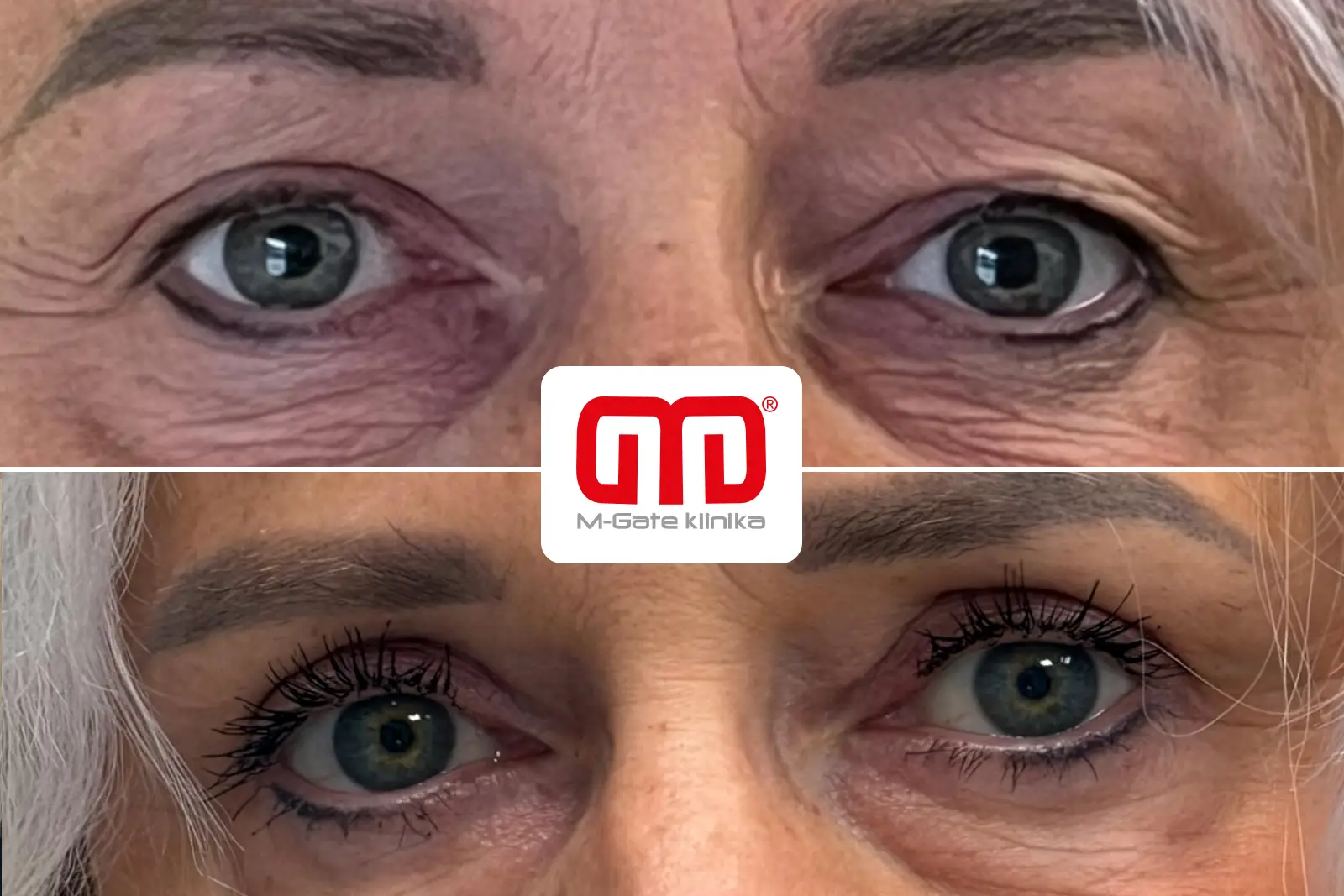 Operace víček - 10