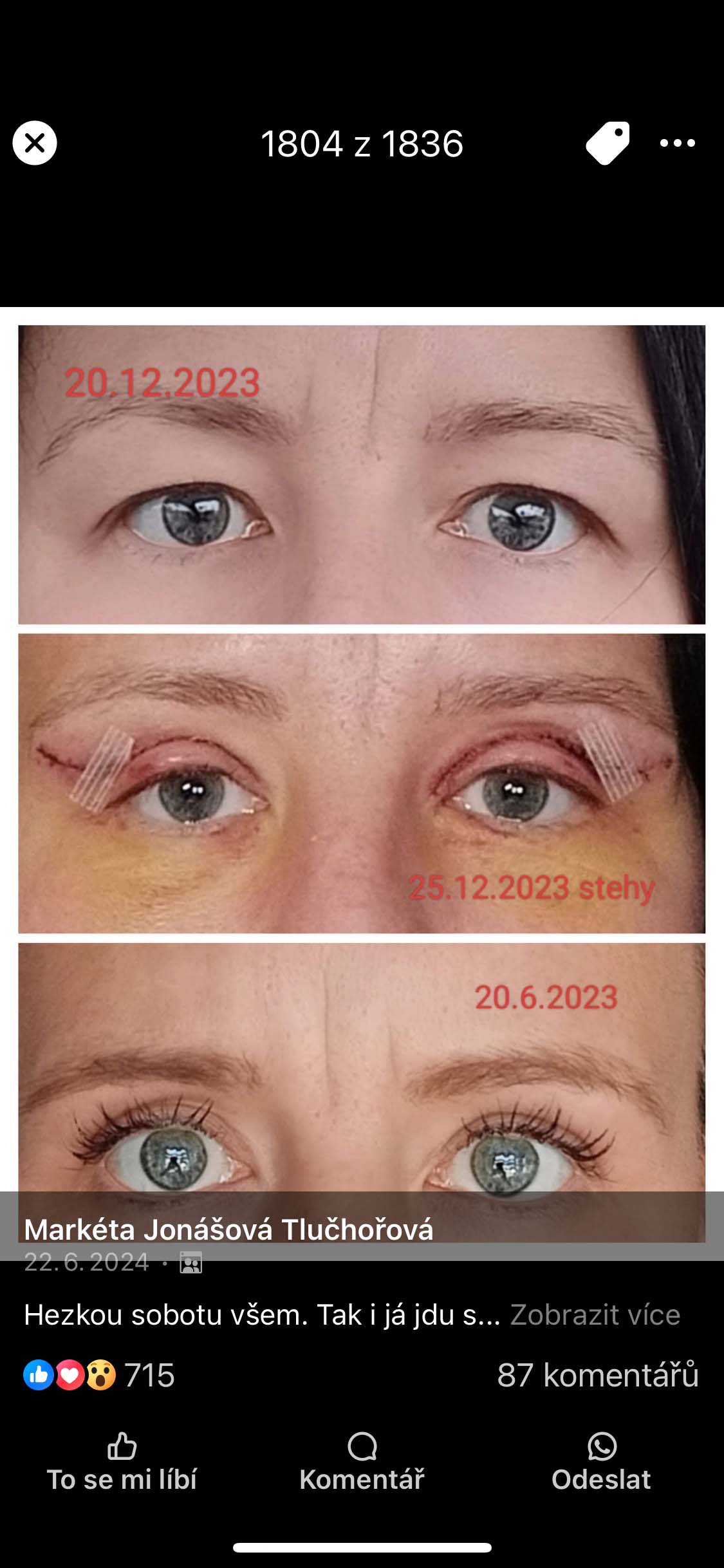 Víčka - 22. 6. 2024