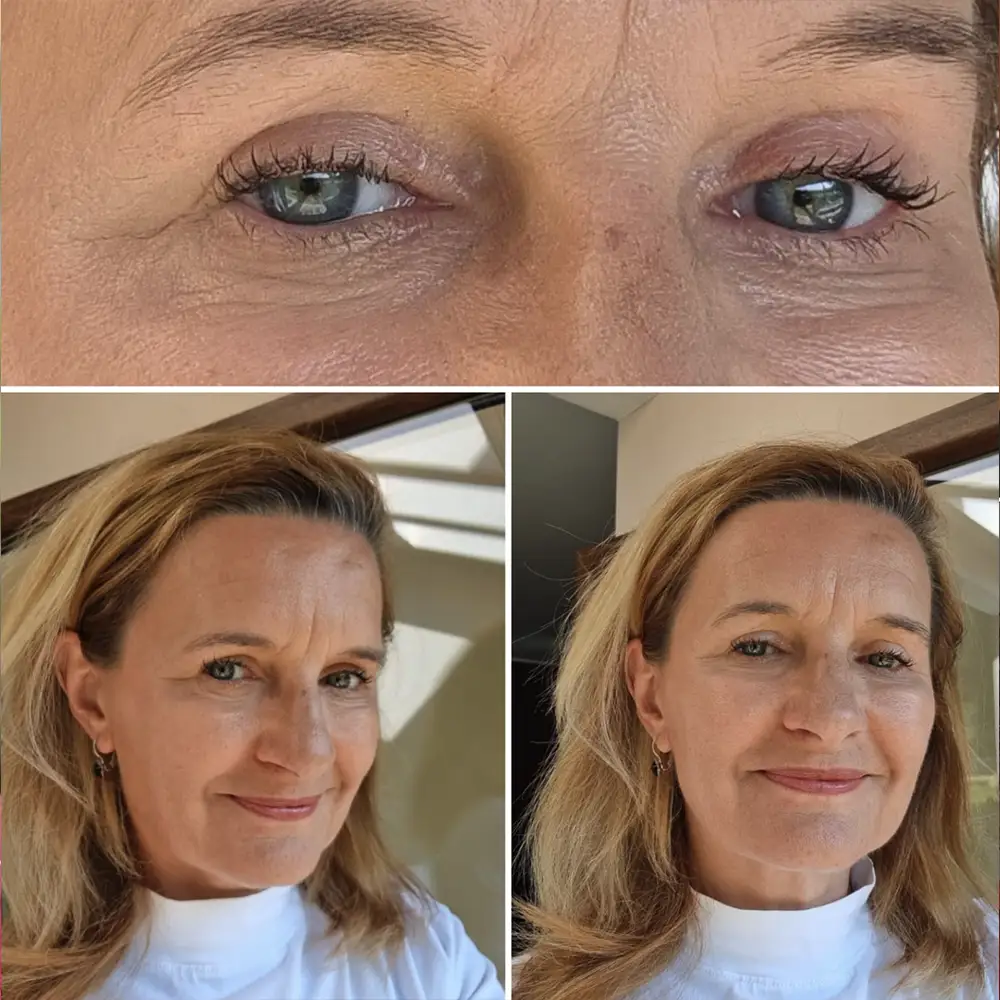 Pavla Kopáčová - víčka