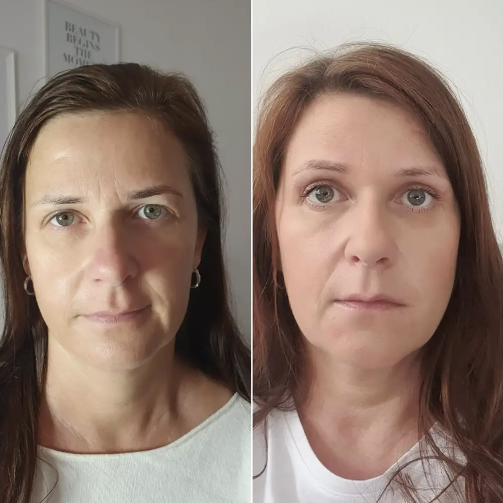 Renata Klásková - víčka