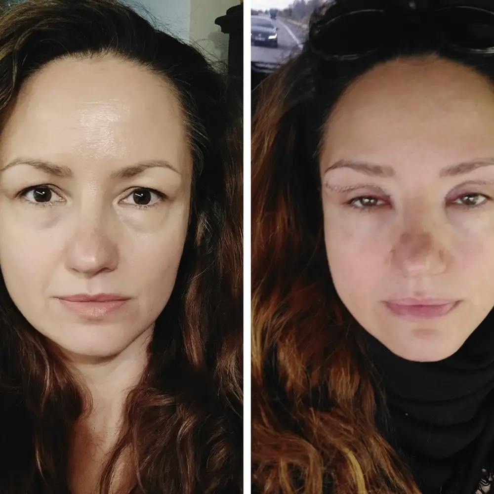 Vendula Andrlová - víčka