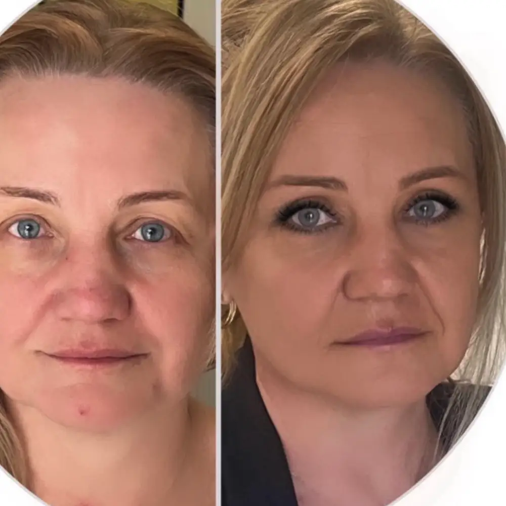 Veronika Bicanová - Víčka